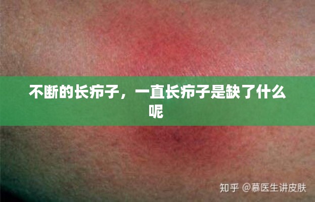 不断的长疖子,一直长疖子是缺了什么呢