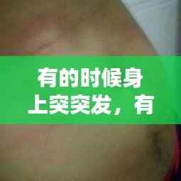 有的时候身上突突发,有的时候突然身上很痒